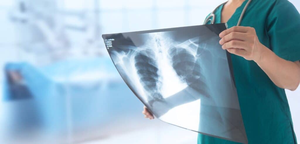 Best X-Ray Jokes to Make You Laugh